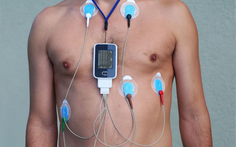 Eletrodos conectados a um gravador portátil de Holter fixados no tórax de um paciente